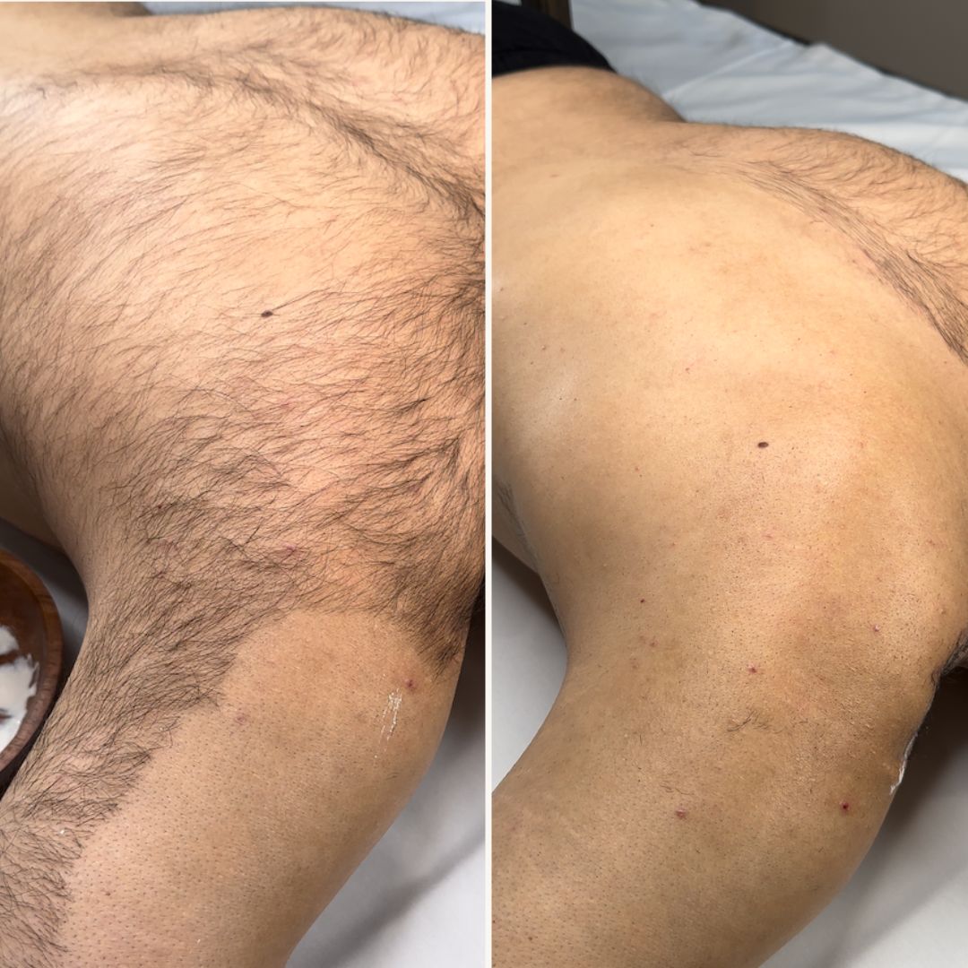 Hair Slayer Body Hair Removal Powder