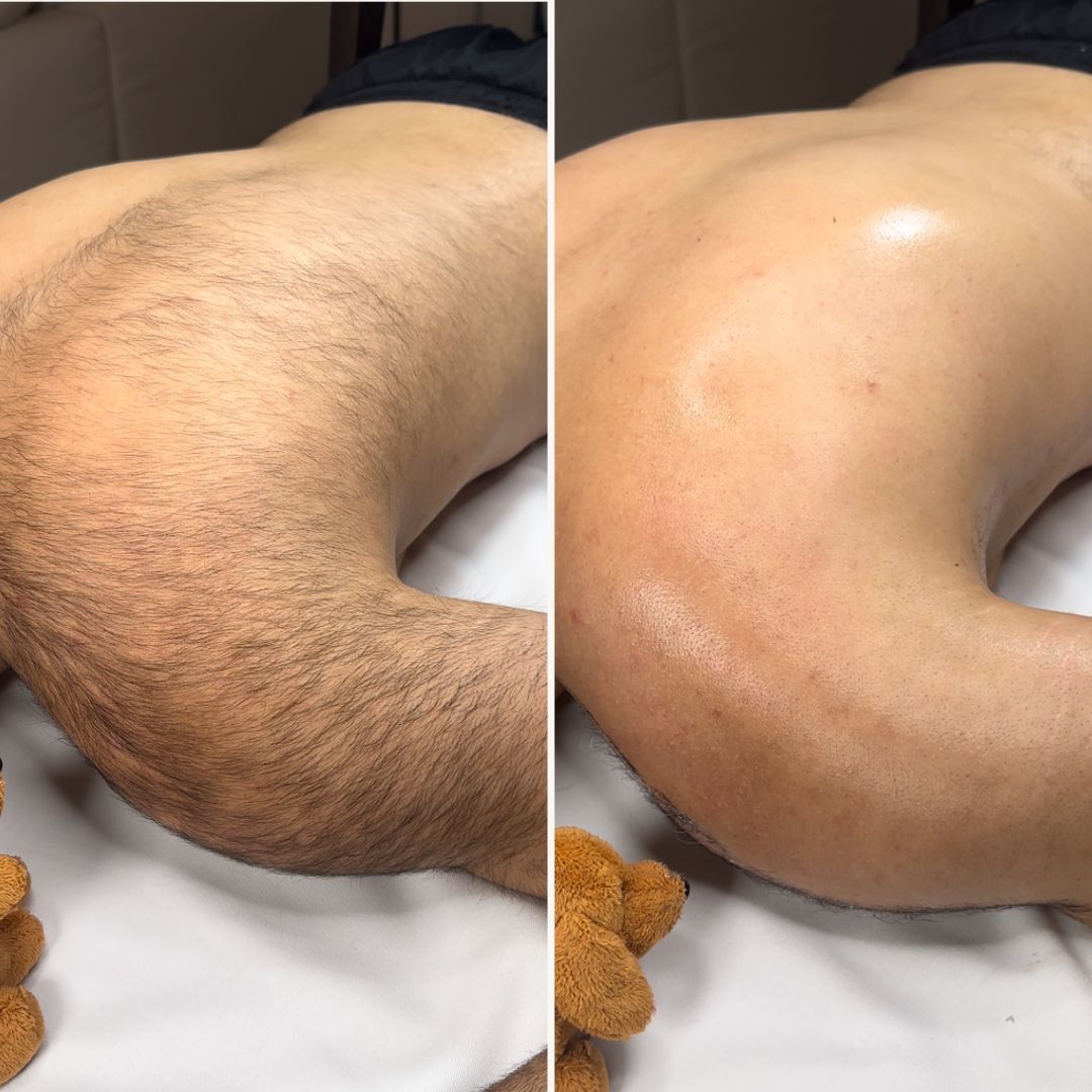 Hair Slayer Body Hair Removal Powder