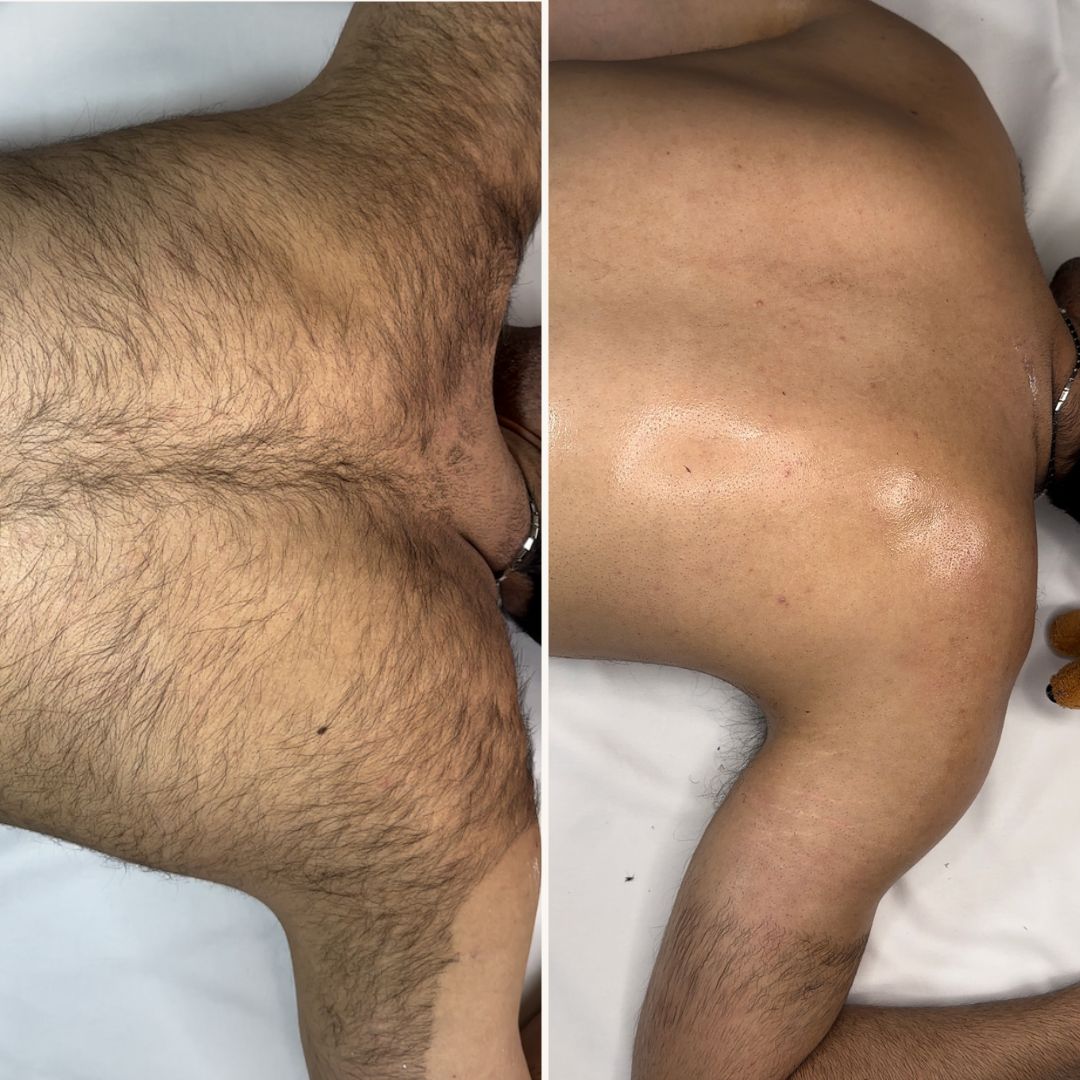 Hair Slayer Body Hair Removal Powder